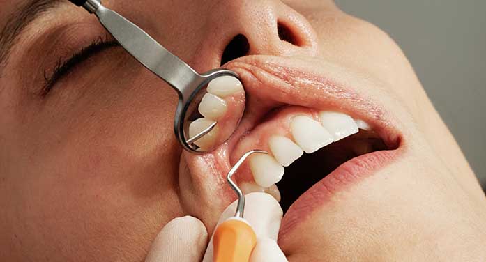 dentist dental oral hygiene teeth mouth