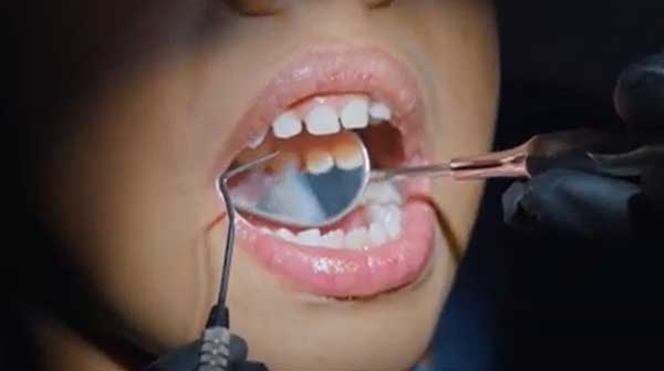 Dental-teeth-dentist