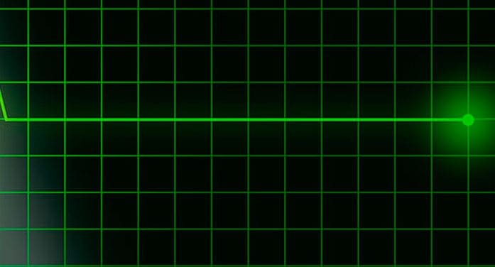 heart attack electrocardiogram