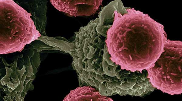 cancer cells